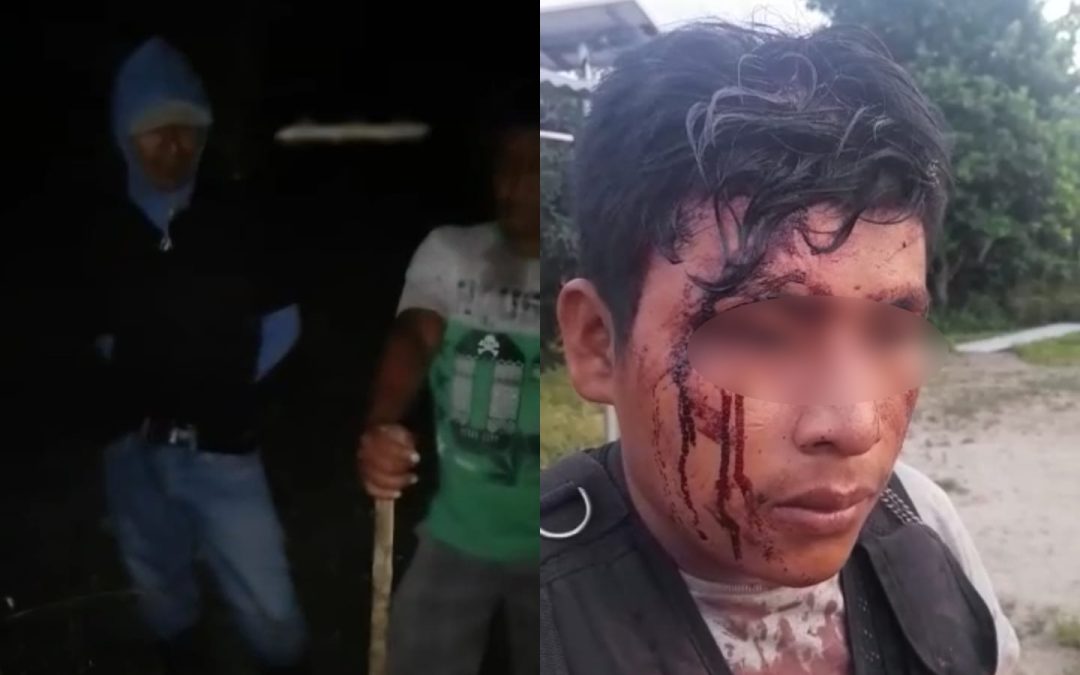 San Martín: Un muerto y al menos siete heridos deja enfrentamiento con invasores en comunidad awajún